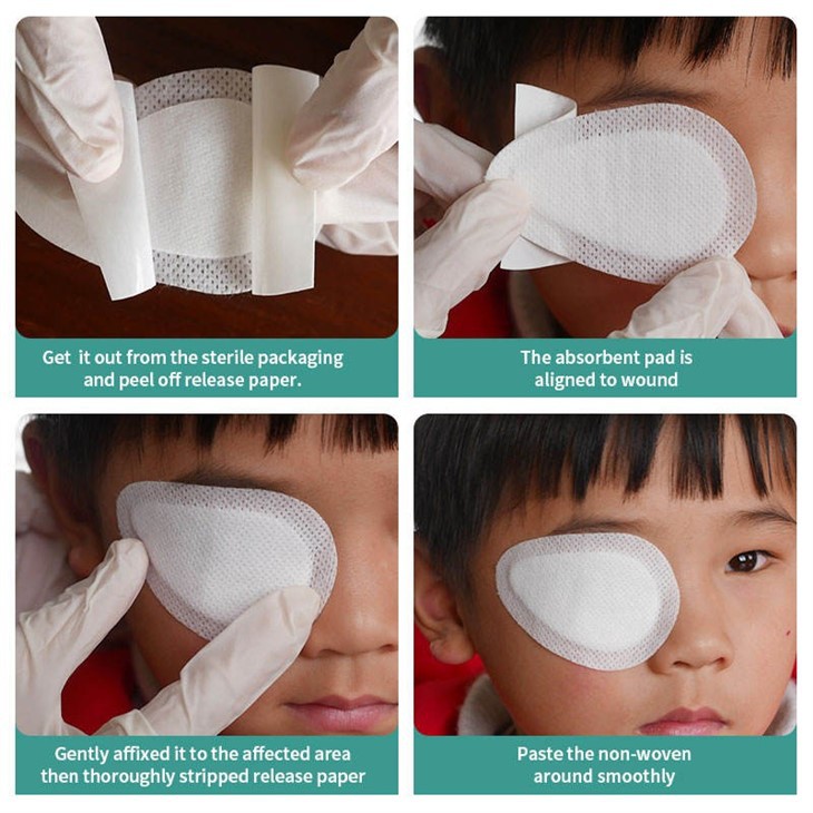Sterile Gauze Eye Pads